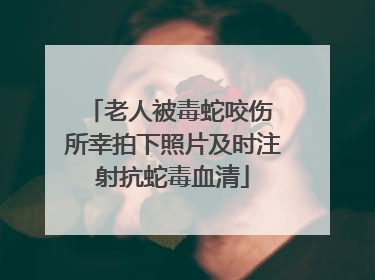 老人被毒蛇咬伤 所幸拍下照片及时注射抗蛇毒血清